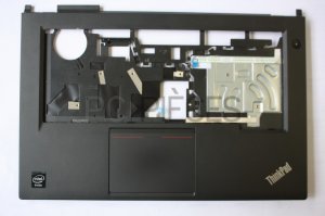 Plasturgie coque superieure LENOVO THINKPAD L440